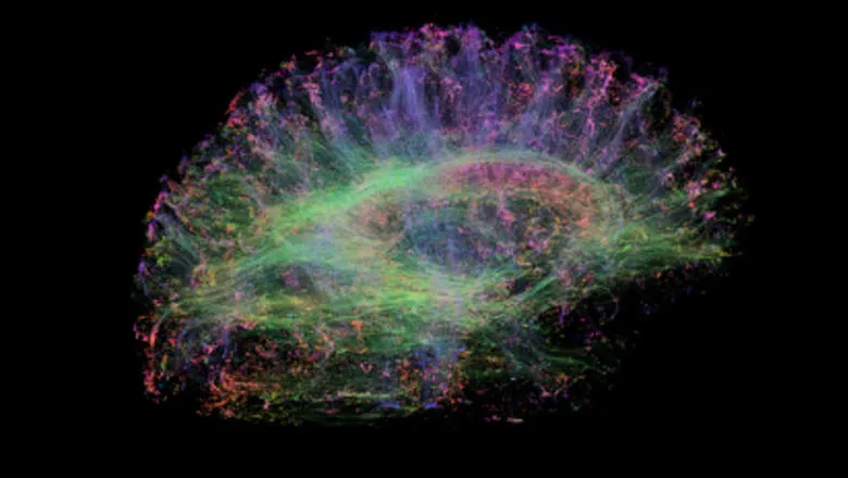 kies teaching correct ratio brain scan