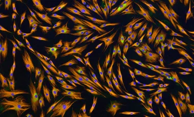 thumb-stem-cells-at-lunch